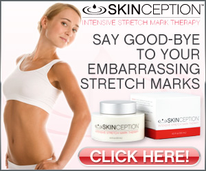 Skinception™ Intensive Stretch Mark Therapy